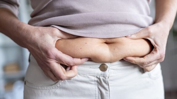 A woman pinching her belly fat.