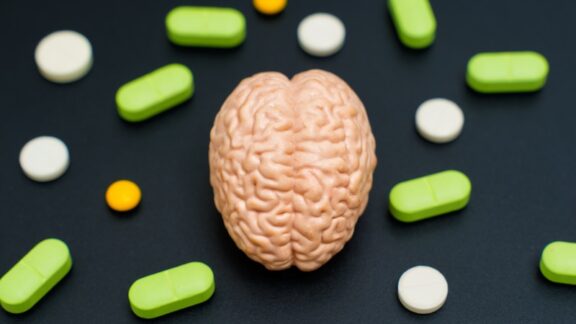 Pills and a brain. Do brain health supplements work?