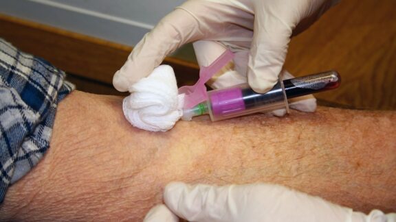 A man getting his blood taken for PSA testing